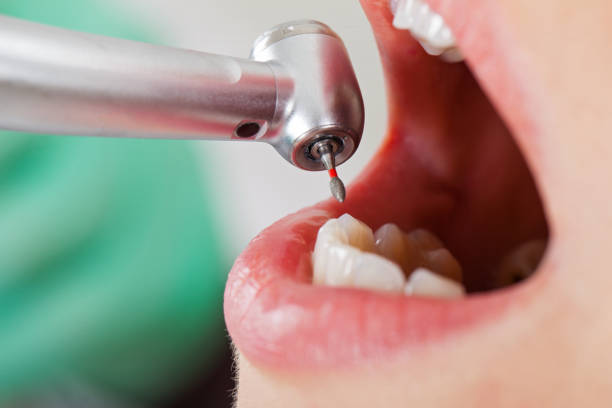 Best Affordable Emergency Dental Care  in Lone Oak, TN